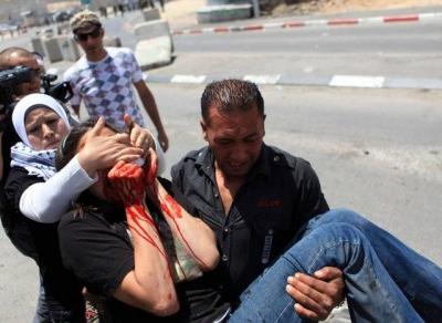 Aktivistin von Tränengasgranate beschossen